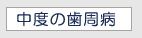 中度の歯周病 