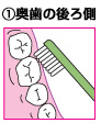 予防歯科
